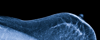 App and Env Microbio.:女性乳房中竟然存在微生物！