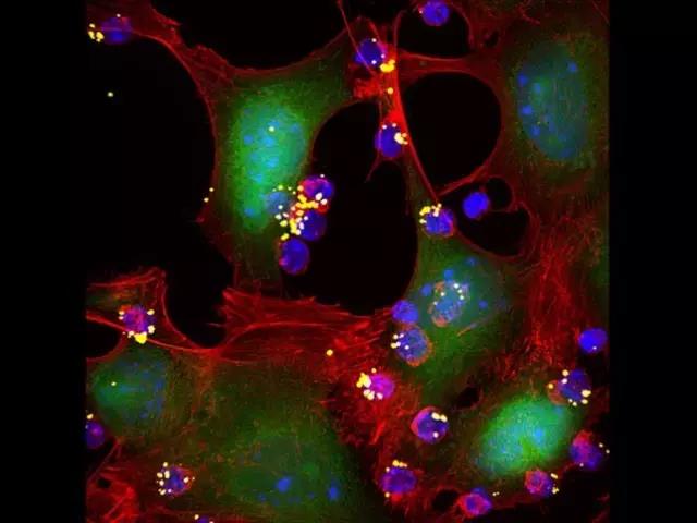 重大突破！MIT科学家用联合免疫疗法，根除小鼠「巨型」实体瘤