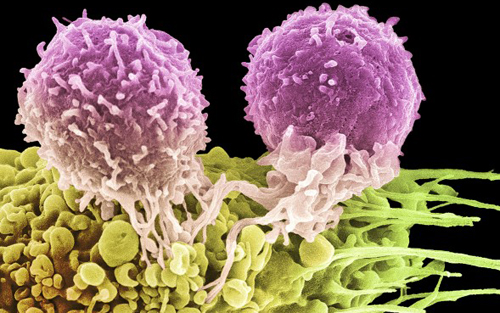 多发性骨髓瘤的CAR-T细胞治疗现状