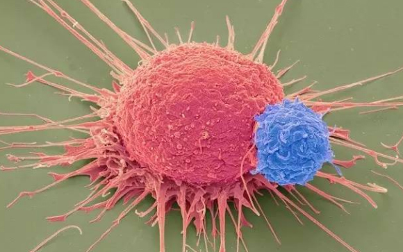 【纽约时报】聚焦癌症免疫疗法的致命风险，为什么产生以及如何应对