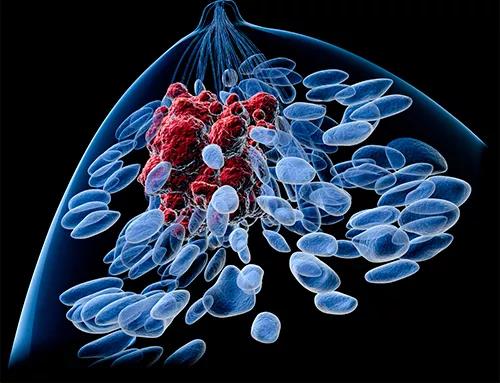 PNAS：年轻女性最易患的乳腺癌，其致死率最高亚型有了研究新进展！