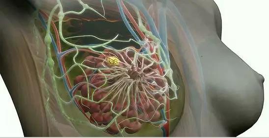 突破！线粒体DNA或是三阴性乳腺癌早期诊断和治疗的新靶点！