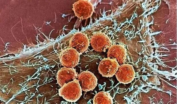 CRISPR助力CAR-T疗法：无需抽取自体细胞也可治疗恶性肿瘤