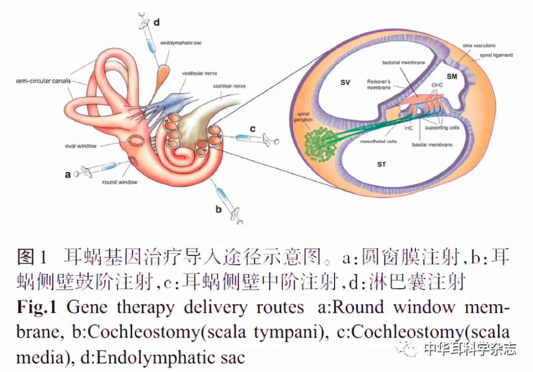 耳聋动物内耳基因治疗现状