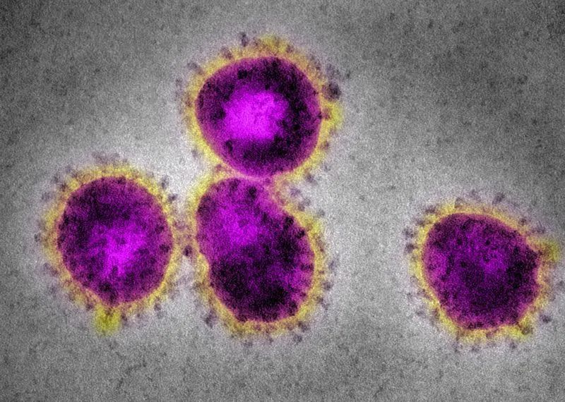 【研究】新冠肺炎致死元凶：「细胞因子风暴」或由ACE2介导！