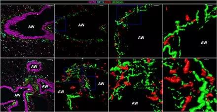 【研究】究竟如何鉴别神经相关的肺间质巨噬细胞亚群