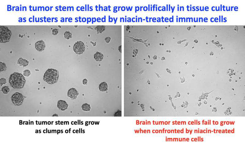 【Science 子刊】烟酸可能有助于免疫系统对抗脑肿瘤