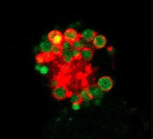 【新发现】 新分子机制可调节免疫系统的巨噬细胞