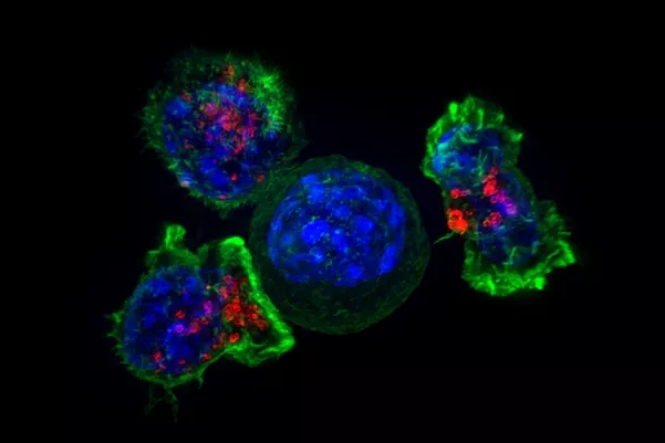 【新发现】美国科学家开发两个小分子FTO抑制剂，能抑制多种肿瘤