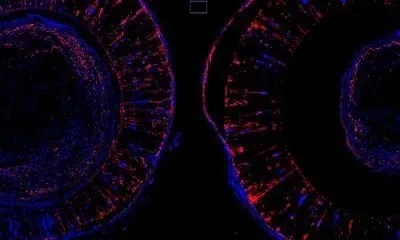 【Cell子刊】新发现！巨噬细胞和神经“肝胆相照”，一同助力骨骼修复