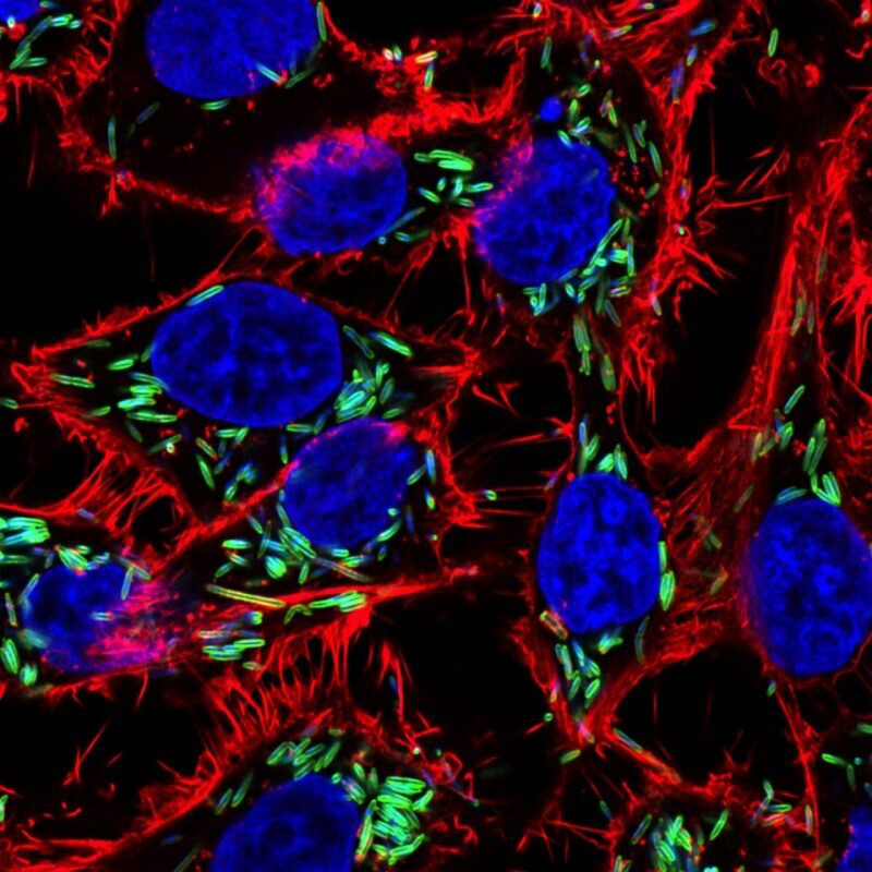 【Science子刊】《科学信号》封面文章，揭示口腔细菌导致结直肠癌扩散的机制