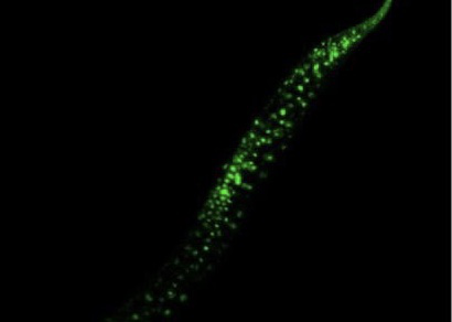 【Science子刊】秀丽隐杆线虫为人类抗衰老带来新希望，VRK-1蛋白是关键！