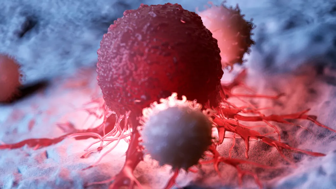 【Gastro】名古屋大学发现：“打破”两种细胞间的平衡就可抑制肿瘤扩散！