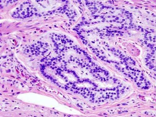 【PNAS】牛奶和牛肉养活不地道的“邻居”！长期“骚扰”并最终导致大肠患癌！