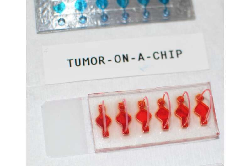 【进展】在器官芯片上探索癌症的个性化免疫治疗