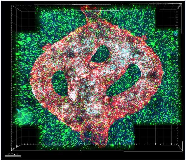 【Science子刊】颠覆！首次3D打印出完整的活体肿瘤，癌症探索迈入“真实“3D时代“