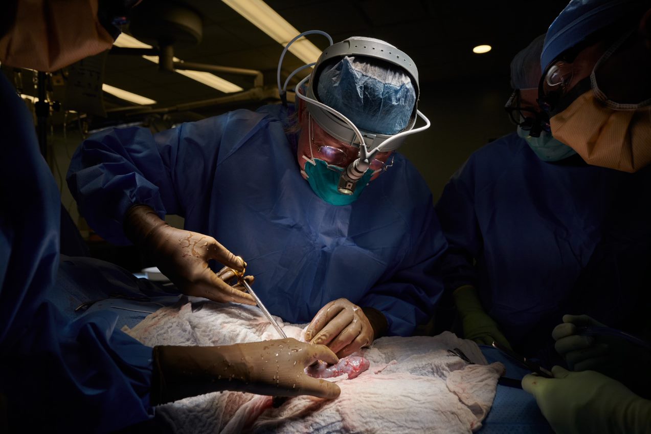 全球首例异种移植手术成功完成！猪肾移植到脑死亡人体未出现排异反应，异种移植有望成为现实！