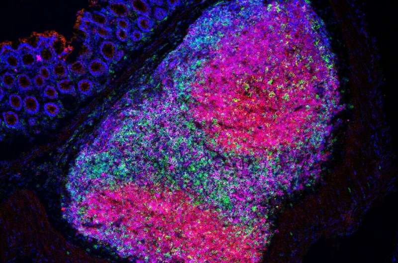 【Cell子刊】在肠道微生物组中加入一种细菌，可增强抗肿瘤免疫