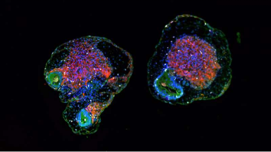 【Cell子刊】类器官培育的香饽饽——利用获诺贝尔奖的诱导多能干细胞iPSC培育出了一种特殊的心脏类器官