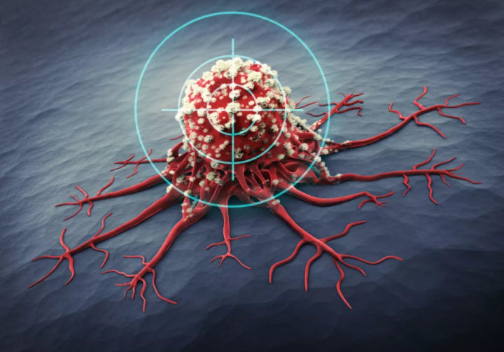 【PNAS】细胞过程展示胰腺癌的新治疗方法——抑制一种关键蛋白会限制癌症！