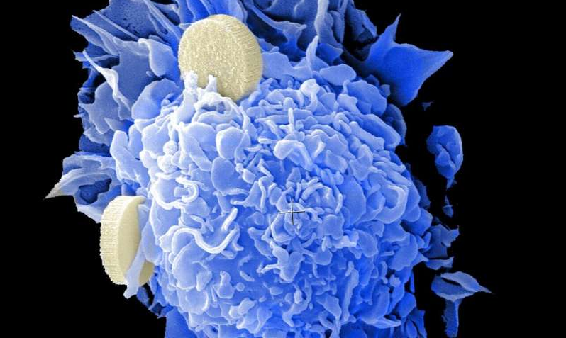 【ACS】癌症研究：老药新用，多种旧药可抑制癌细胞扩散！