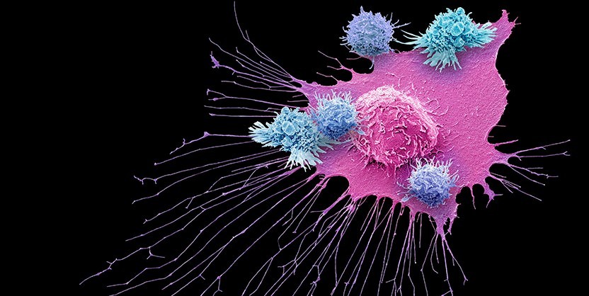 【Cell子刊】研究发现最常见胰腺癌的新治疗靶点！