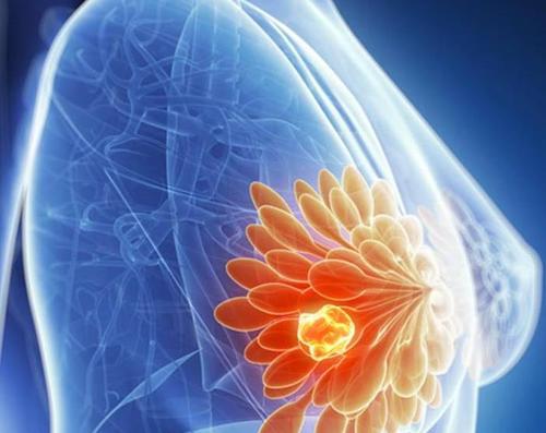 【研究】发现引起乳腺癌内分泌治疗耐药性的新基因！