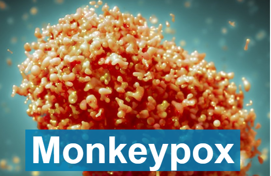 全球猴痘确诊病例，首次达到千位数！一波未平一波起：严防猴痘！！
