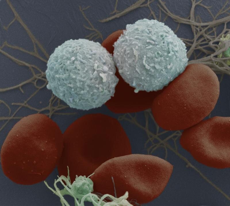【Science子刊】不伤害健康干细胞！阻断特殊蛋白质以靶向白血病干细胞！