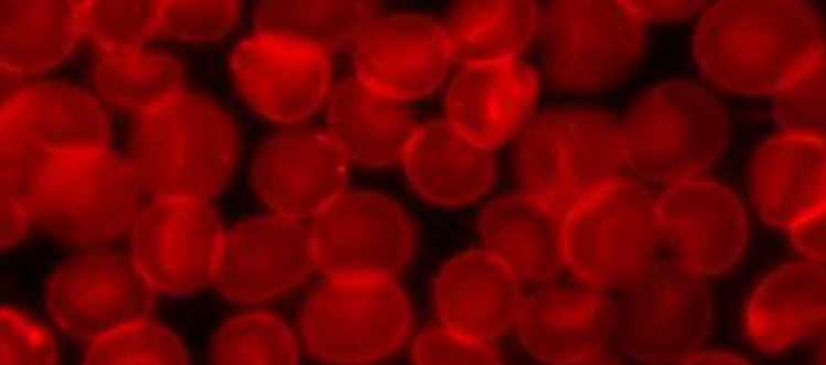 【Nature子刊】科学家发现影响白血病前期风险的基因！