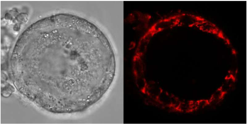 【Nature】保持生育能力50年，揭秘人类卵母细胞如何超长“待机”