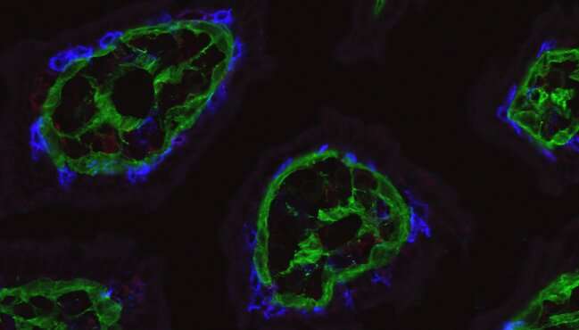 【Science子刊】新视角！T细胞为什么会保护肠道健康？