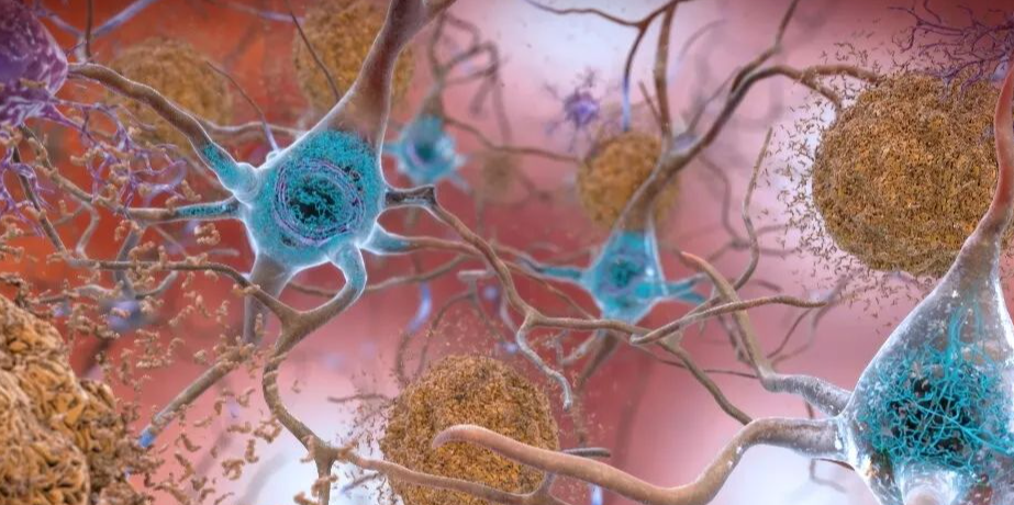 【Cell子刊】新方法！利用基因嵌入鉴定阿尔茨海默病的风险基因