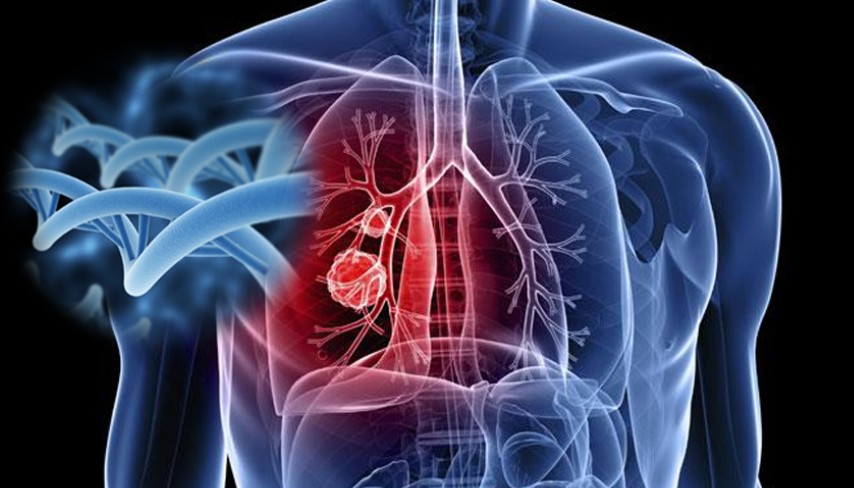 【Cancer Cell】南医大沈洪兵、胡志斌团队揭示肺癌致病变异的遗传新机制