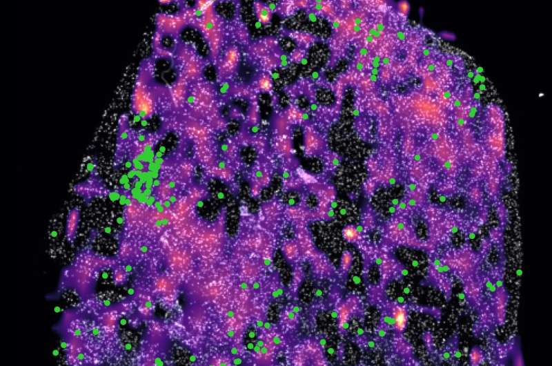 【Science】哈佛最新研究表明：癌症会中和T细胞以破坏免疫系统， 加速肿瘤生长