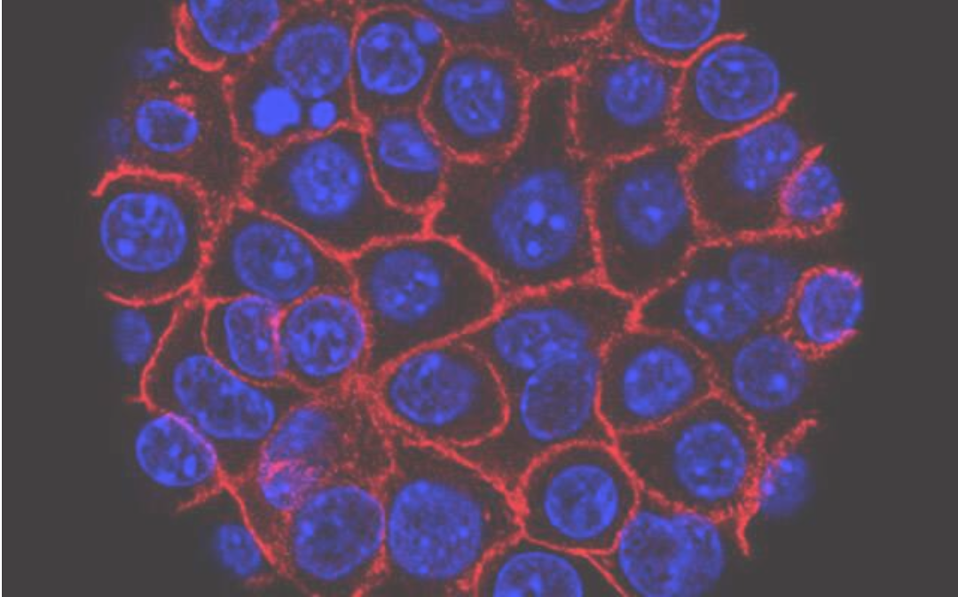 【Science子刊】震惊！国外大学团队研究发现：影响胰腺癌细胞生长和移动的元凶竟是它！