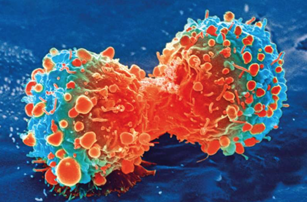 【BMC MED】北京协和研究团队研究促进非小细胞肺癌抗肿瘤活性的新方法