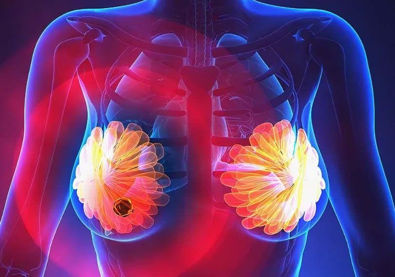 【PNAS】“复旦四分型”再完善！邵志敏教授团队绘制最毒乳腺癌“肿瘤特异性转录本”图谱