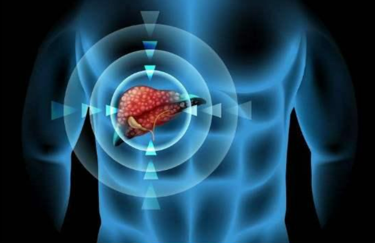 中南大学研究证实肝癌病理分型与体液免疫缺陷有关！