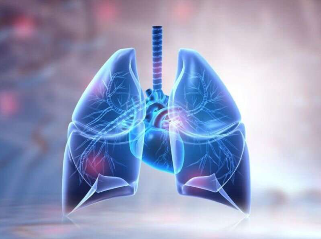 3种技术+超12万人研究！遵义医科大学研究发现增加患肺癌风险的潜在因果关系