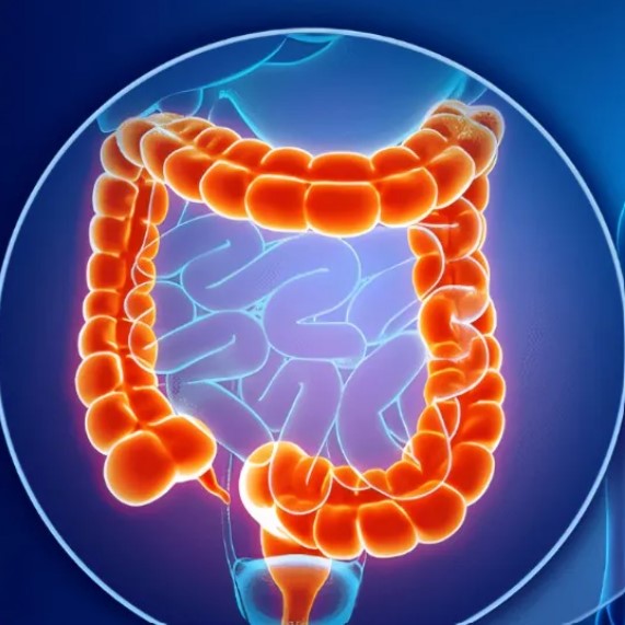 【Gut】香港中文大学于君团队发现YTHDF1可增强结直肠癌的抗肿瘤免疫并增强抗PD-1的疗效