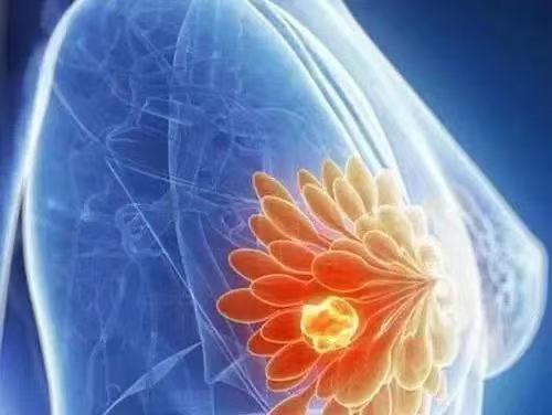 【Science子刊】澳大邓初夏团队研究揭示肿瘤微环境促乳腺肿瘤进展的调控机制