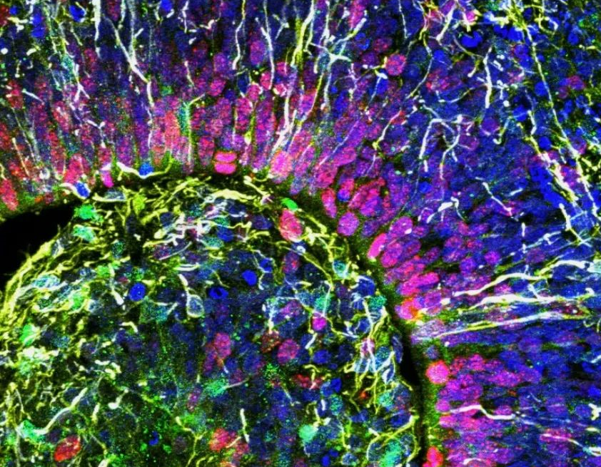 【Cell子刊】人脑类器官首次接替大鼠大脑对光产生了反应，迈出重建受损大脑的第一步！