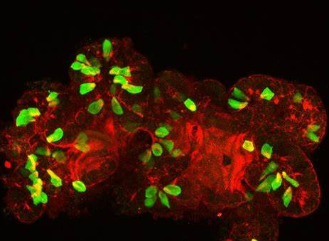 Hans Clevers 团队类器官研究再突破！新型人脂肪肝类器官可用于CRISPR筛选新靶点药物