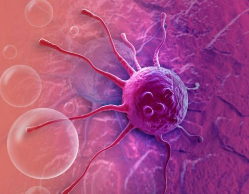 【PNAS】癌转移重大发现！肿瘤内坏死区域在癌细胞分泌的蛋白质帮助下促进癌症扩散