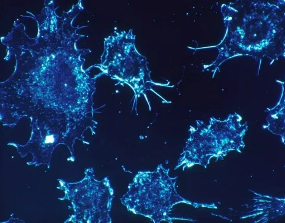 山东大学齐鲁医学院张娜、刘永军团队发现重塑肿瘤免疫抑制微环境以提高肿瘤治疗效果的关键策略