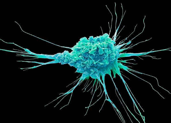 【Nature子刊】最新！斯坦福大学研究人员在肿瘤联合治疗方面取得突破！