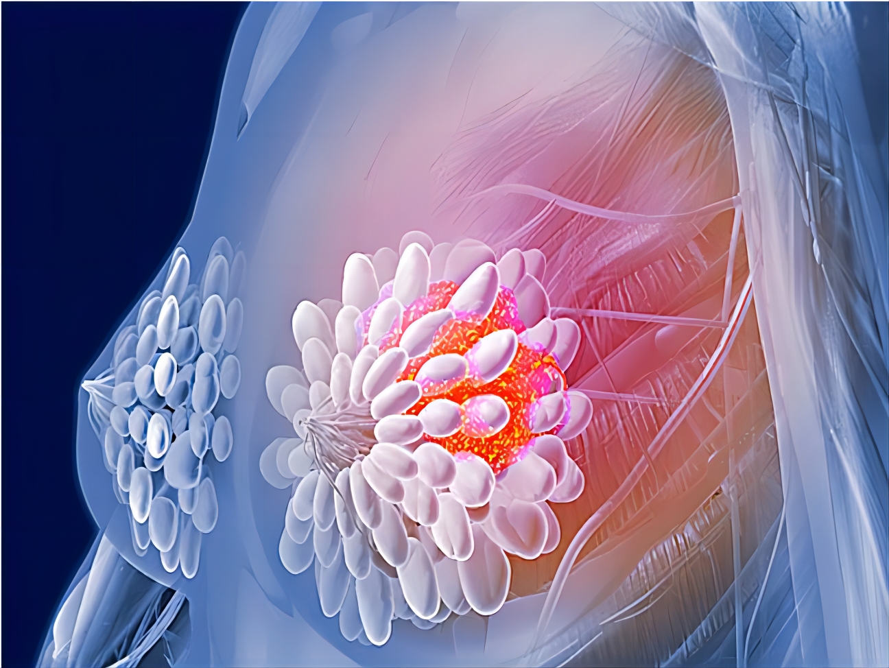 【Nature】重磅！哈佛医学院最新研究揭示乳腺癌进展新机制