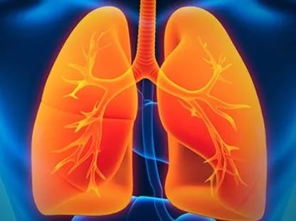 【Nature子刊】中山大学方文峰/张力/黄岩发现这种类型的非小细胞肺癌潜在治疗新策略