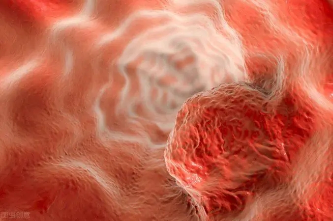 【Nature子刊】最新！温州医科大学等合作发现食管癌诊断生物标记物